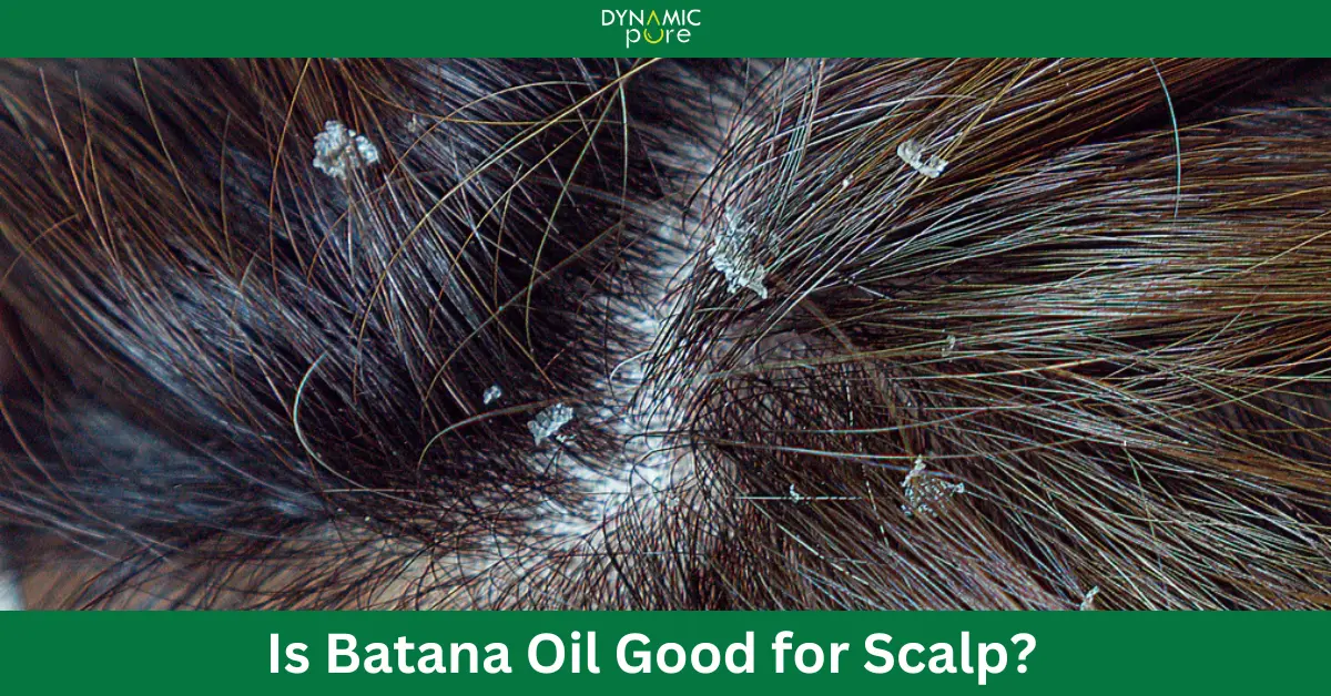 Is Batana Oil Good for Scalp