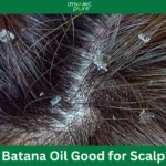 Is-Batana-Oil-Good-for-Scalp-1.webp